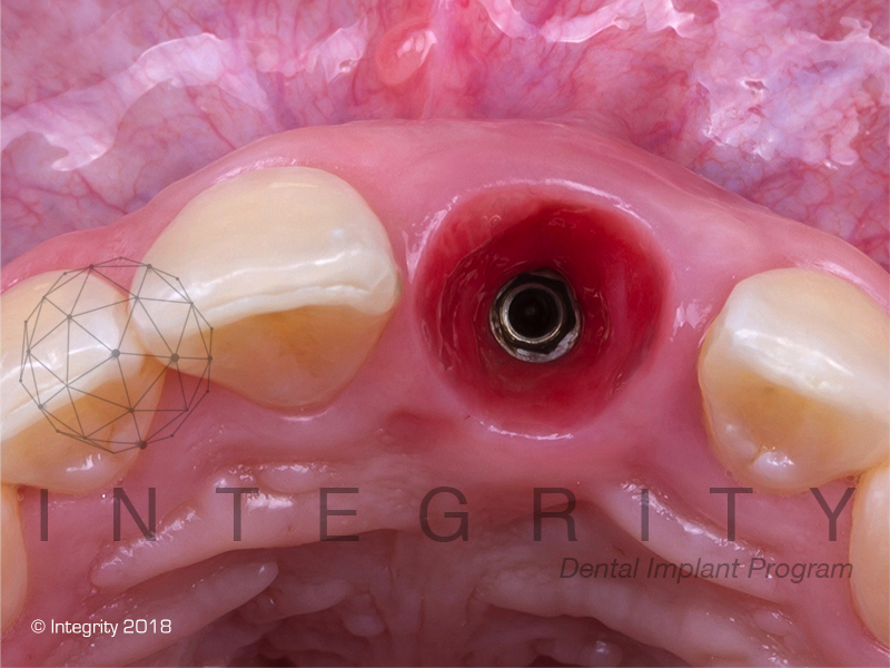 Integrity-cicatrizacion